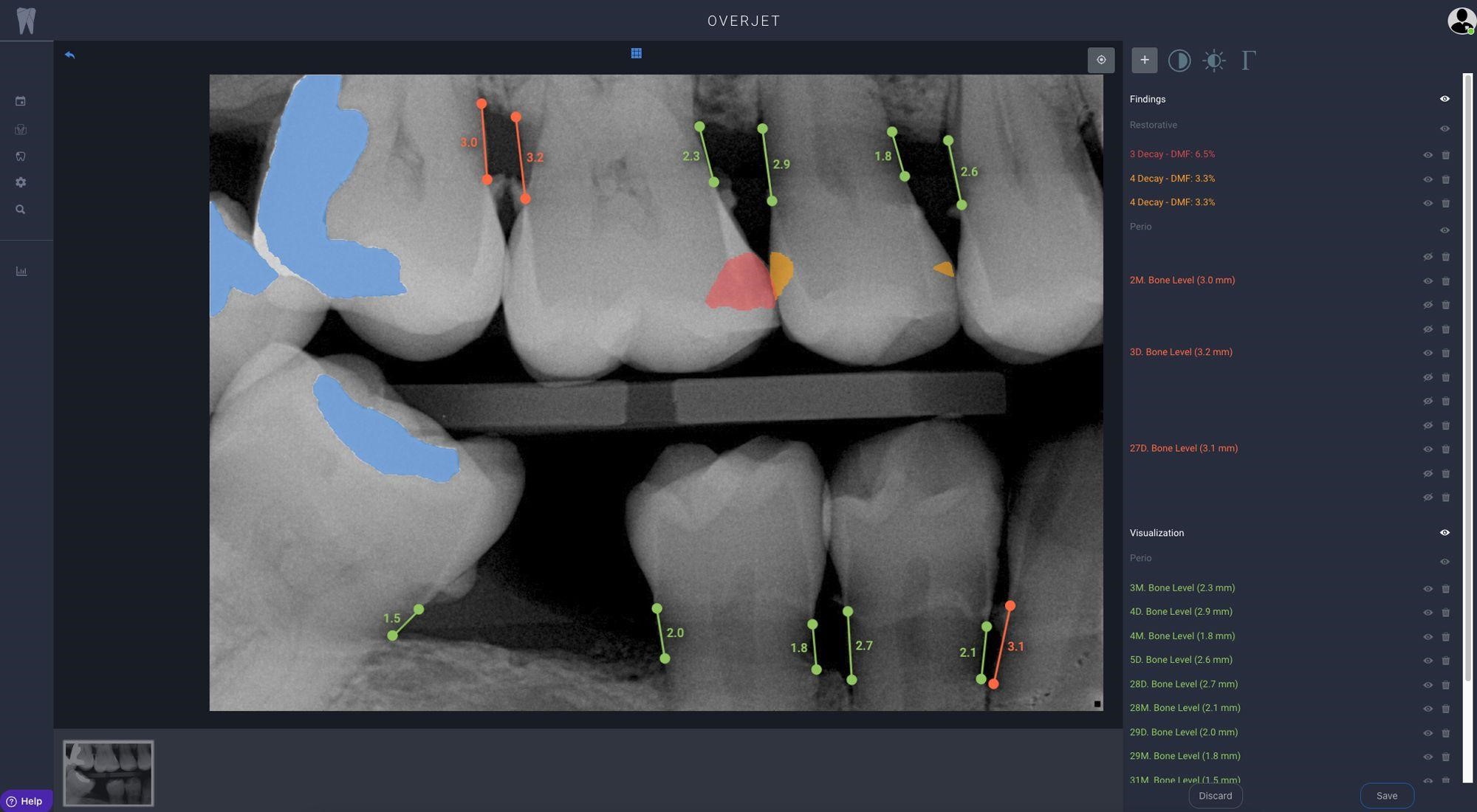 Dental Imaging & Analysis