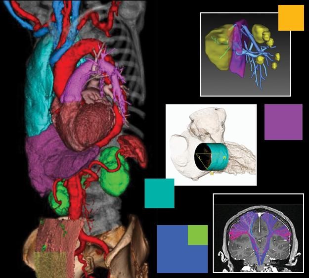 2D & 3D Imaging