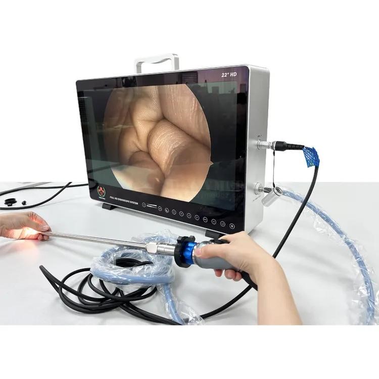 Endoscopic & Internal Imaging